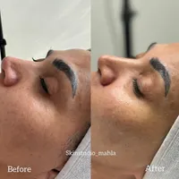 پاکسازی و فیشال تخصصی مشاوره رایگان|خدمات آرایشگری و زیبایی|تهران, حکمت|دیوار