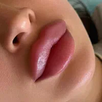 مدل ژل و بوتاکس و فیلر و مزو آنزیم پی ار پی|خدمات آرایشگری و زیبایی|کرج, گوهردشت|دیوار