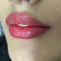 کلینیک پوست ومومایا|خدمات آرایشگری و زیبایی|کرج, شهرک اوج|دیوار