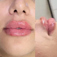 تخفیف تکرارنشدنی