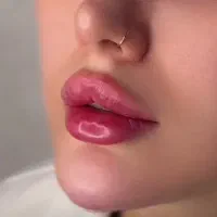 ژل لب بوتاکس مزو ابرو مزو جوانساز