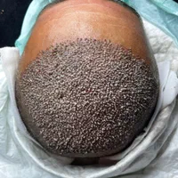 کاشت مو ابرو|خدمات آرایشگری و زیبایی|یاسوج, |دیوار