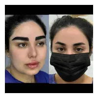 جشنواره کاشت و ابرو فقط ۱۱ تومان تا یک هفته