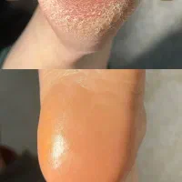 آموزش پدیکور و پارافین تراپی و ارتونیل|خدمات آموزشی|اصفهان, مرداویج|دیوار