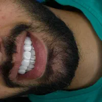 ویزیتور دندان پزشکی