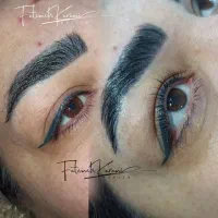 آموزش لیفت با قیمت استثنایی