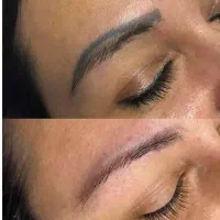 ریموتتوبالیزرکیوسوئیچ‌ لیزرکربن مزونیدلنگ فشیالvip