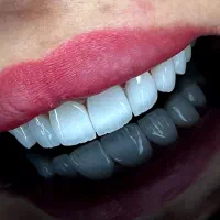 مرکز طراحی لبخند دیجیتالی بدون پیش پرداخت|خدمات آرایشگری و زیبایی|اصفهان, گلزار|دیوار