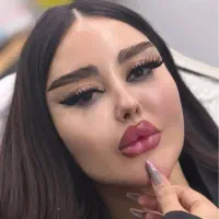 جشنواره50٪تخفیف فیلرمادلینگ صورت،کانتورینگ چانه لب|خدمات زیبایی و سلامت|تبریز, |دیوار