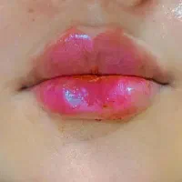 ژل فیلر بوتاکس آفر ویژه|خدمات آرایشگری و زیبایی|شیراز, سلطان آباد|دیوار