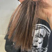 موخوره گیری تخصصی فقط با ۳۹۰ تومان برای ۱۰ نفر اول