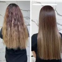 کوتاهی مو و موخوره گیری .کات لیزری