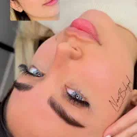 میکرو بلیدینگ رایگان (فوری ) فردا