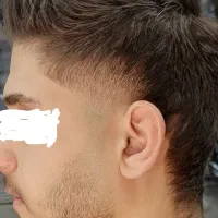 اصلاح رایگان بشرط عکسبرداری