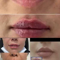 تخفیفات فقط تا آخر شهریورماه.مشاوره رایگان|خدمات آرایشگری و زیبایی|یاسوج, |دیوار