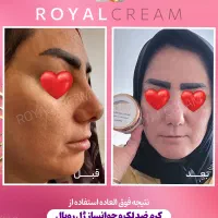 کرم ژل رویال