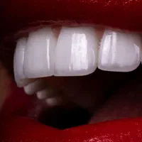 آموزش دندانسازی بخش متحرک( دندان مصنوعی)|خدمات آموزشی|تبریز, |دیوار