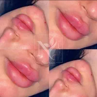 فروش ژل بوتاکس نخ و لوازم بهداشتی کلینیک  زیبایی|خدمات آرایشگری و زیبایی|تهران, قیطریه|دیوار