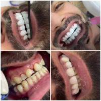دندانپزشکی وزیبایی