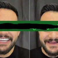 لابراتوار دندانسازی