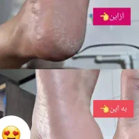 کفسابی و پدیکور|خدمات آرایشگری و زیبایی|کرمان, |دیوار