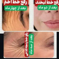 کرم بوتاکس پنج کاره ایتالیایی گاتیو|آرایشی، بهداشتی، درمانی|فولادشهر, فولادشهر|دیوار