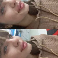 تزریق ژل بوتاکس نخ ...توسط پزشک در کلینیک سایماه|خدمات آرایشگری و زیبایی|کرمان, |دیوار