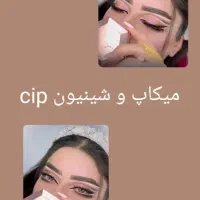 طلا