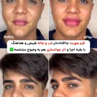 خدمات پوست، مو ، زیبایی|خدمات آرایشگری و زیبایی|تهران, امانیه|دیوار