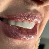 انقلاب دندانپزشکی با اقساط و تخفیفات ویژه