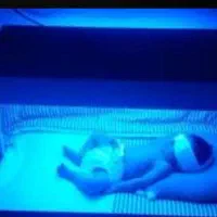 اجاره دستگاه فتوتراپی(درمان زردی نوزاد)