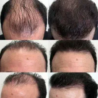 بعد از مدتی موهاتو دم اسبی ببند