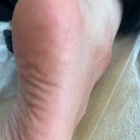 پدیکور تخصصی و اموزش با مدرک فنی حرفه ای