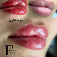خدمات شیدینگ لب|خدمات آرایشگری و زیبایی|تهران, پرستار|دیوار