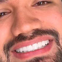 آموزش تخصصی صفر تا صد کامپوزیت|خدمات آموزشی|تهران, اختیاریه|دیوار