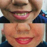 تزریق ژل بوتاکس چال گونه تتو پرسینگ مژه و اموزش|خدمات آرایشگری و زیبایی|اهواز, معین زاده|دیوار