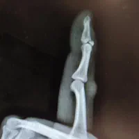 مراقبت از بیمار|استخدام درمانی، زیبایی، بهداشتی|رشت, معلم|دیوار