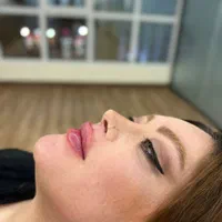 فرصت طلایی برای تزریق ژل و انواع فیلر بوتاکس