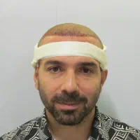 کاشتمو و ابرو|خدمات آرایشگری و زیبایی|تهران, جردن|دیوار