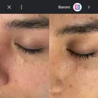 پاکسازی صورت