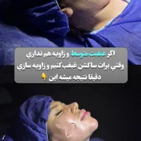 ساکشن غبغب و بوکالفت|خدمات آرایشگری و زیبایی|تهران, فرمانیه|دیوار