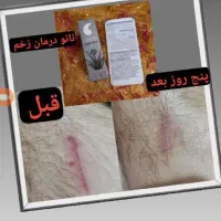 محصولات مراقبتی از پوست مو با محصولات دانش‌بنیان|خدمات آرایشگری و زیبایی|قوچان, |دیوار