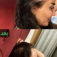 قطع ریزش مو با مورینگا|آرایشی، بهداشتی، درمانی|تهران, میدان ولیعصر|دیوار