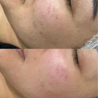 خدمات تخصصی پوست (هلن)