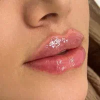 انجام خدمات ژل و بوتاکس و تمامی جراحی ها|خدمات آرایشگری و زیبایی|شهریار, شهریار|دیوار