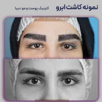 (+فیلم) کلینیک کاشت مو، ابرو و ریش|خدمات آرایشگری و زیبایی|تهران, صادقیه|دیوار