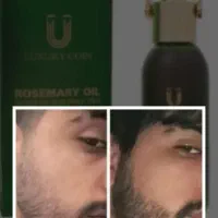 ر.یش مو سبیل ر.یزش سکه ای