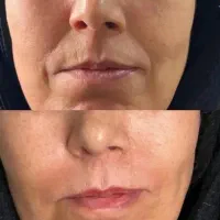 ضد چروک، کلاژن ساز، آبرسان قوی، ضد لک و کک