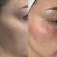 خدمات تخصصی cipپوست کره ای|خدمات آرایشگری و زیبایی|علیآباد کتول, |دیوار