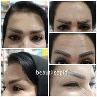 ژل و بوتاکس|خدمات آرایشگری و زیبایی|شیراز, دوکوهک|دیوار
